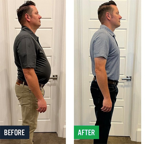 Aaron side before and after