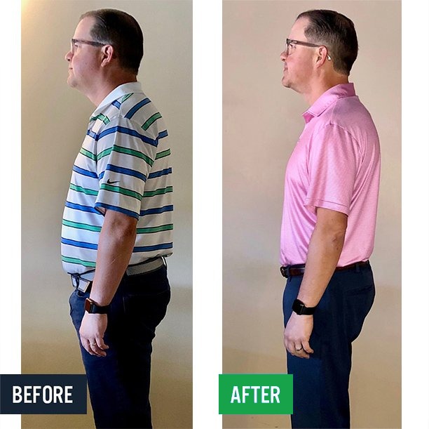 Adam side before and after