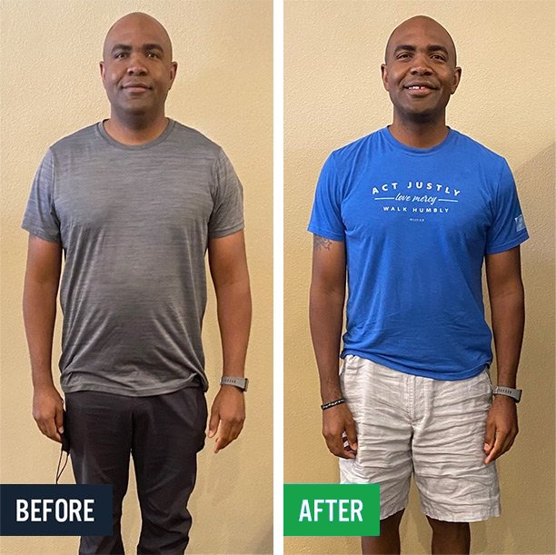 Anthony before and after