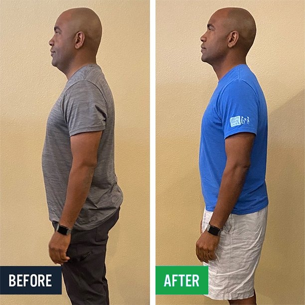 Anthony side before and after