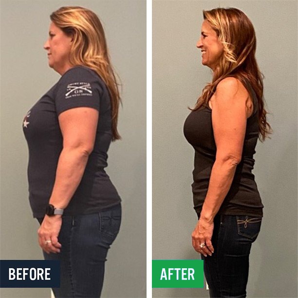 Aprill side before and after