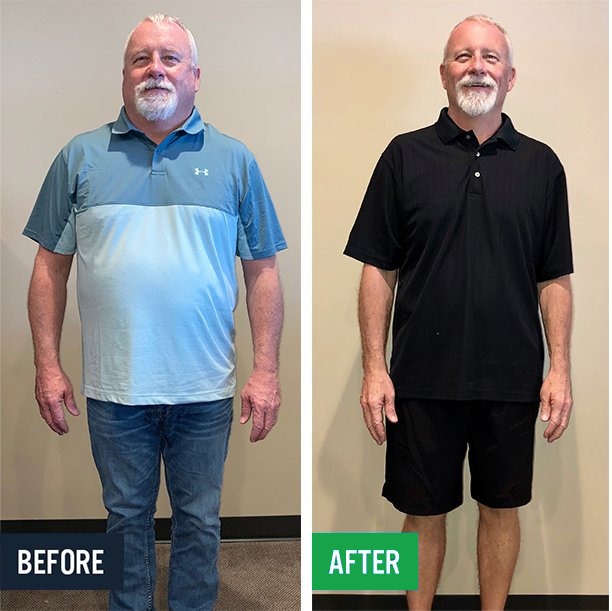 Bill before and after