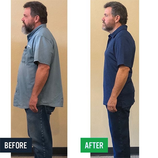 Bob side before and after