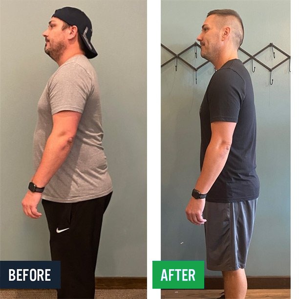 Brad side before and after