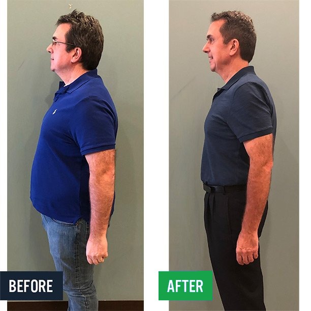 Brian side before and after