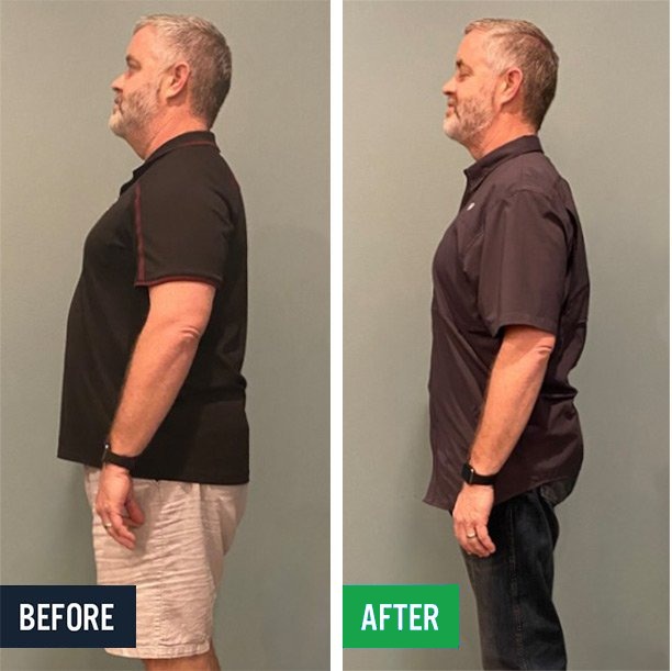 Brian W before and after