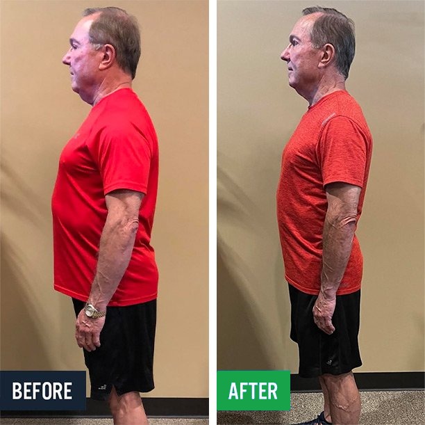 Carey side before and after