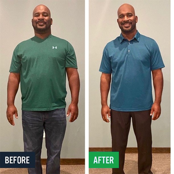 Charles before and after