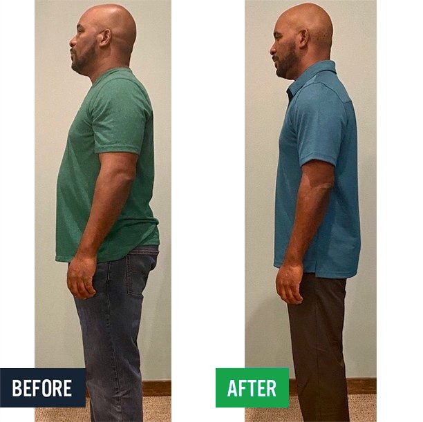 Charles side before and after