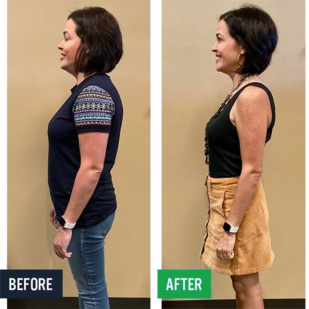 Christina side before and after