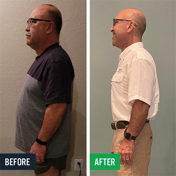 Clark side before and after