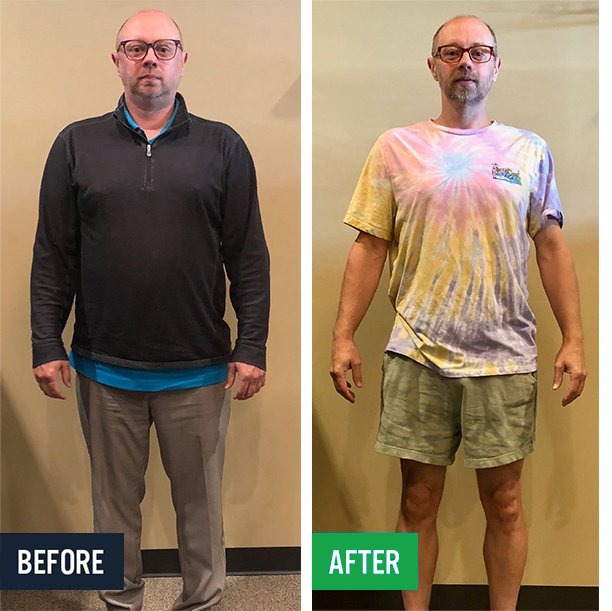 Curt before and after