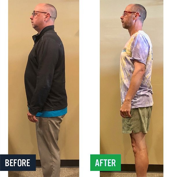 Curt side before and after