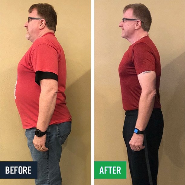 Dan side before and after