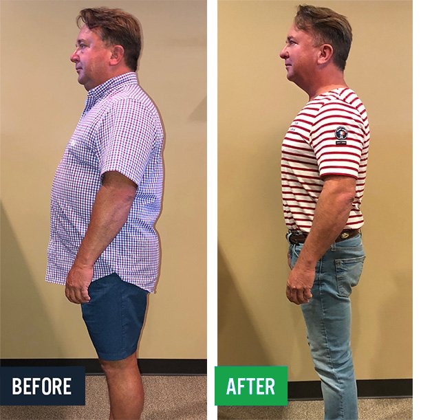 Dave side before and after