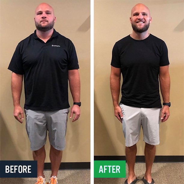 Derek before and after