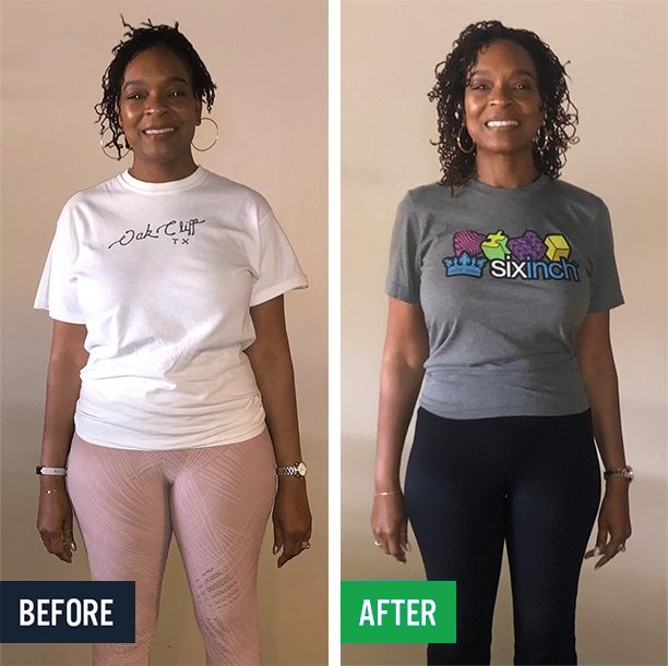 Devonne before and after