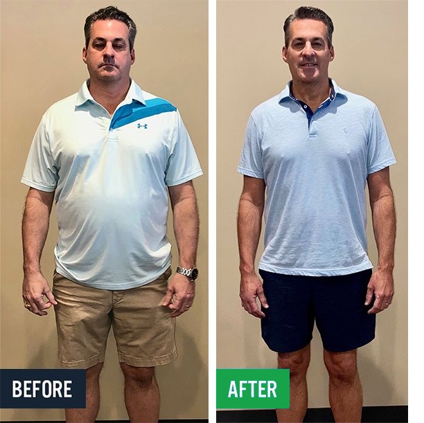 Don before and after