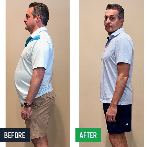 Don side before and after