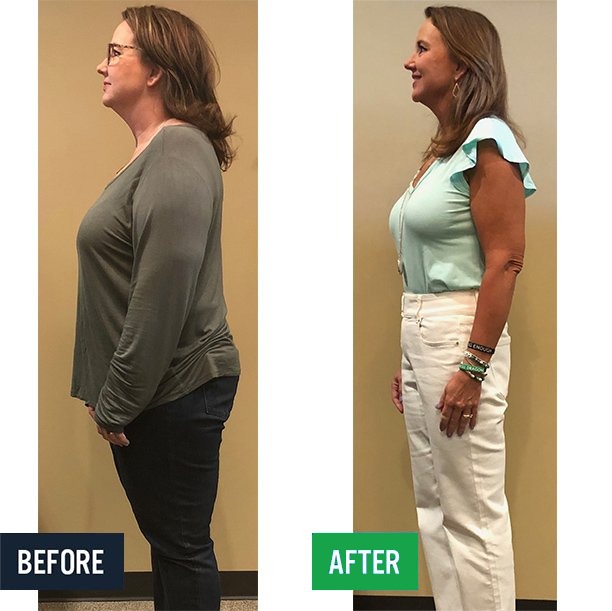 Elizabeth side before and after