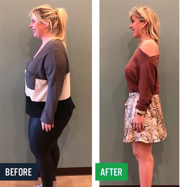 Ella side before and after