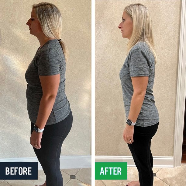 Emily side before and after