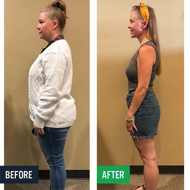 Heather side before and after