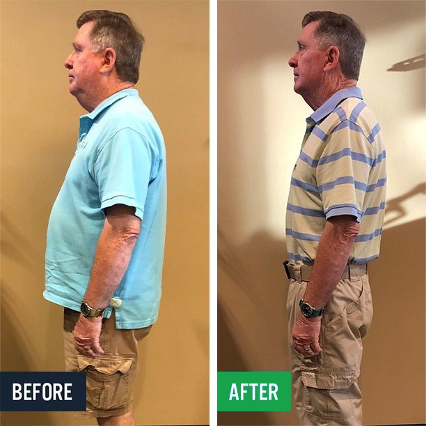 James before and after