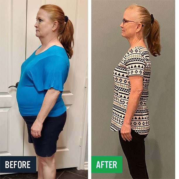 Jami side before and after