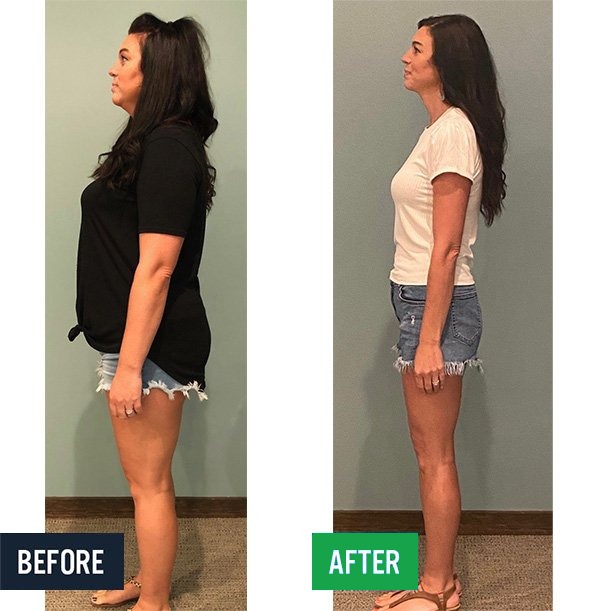 Jamie side before and after