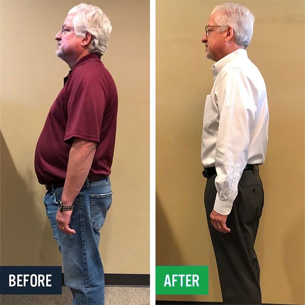 Jeff side before and after