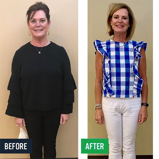 Jennifer before and after