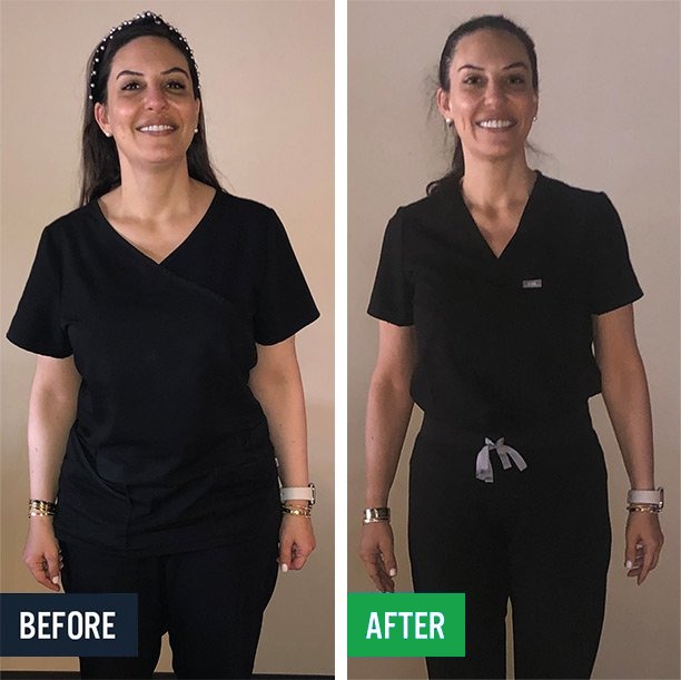 Jessica before and after