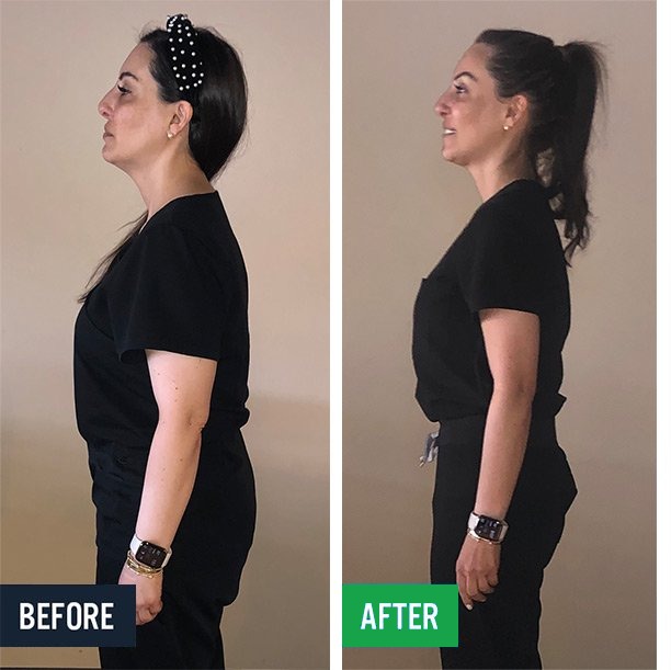 Jessica side before and after