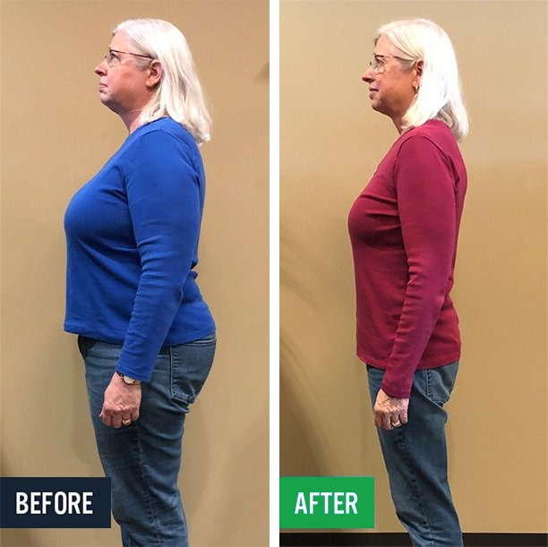 Joyce side before and after