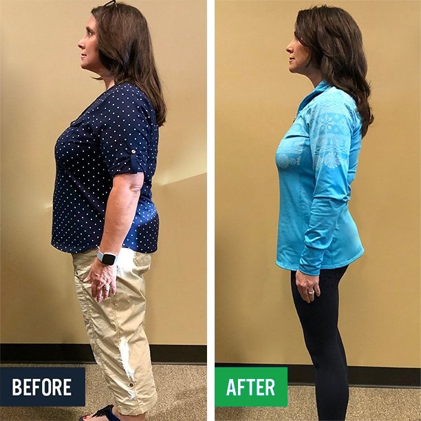 Julie side before and after