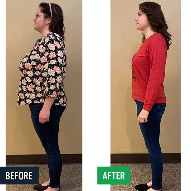 Katie side before and after