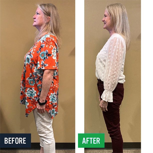 Kelly side before and after