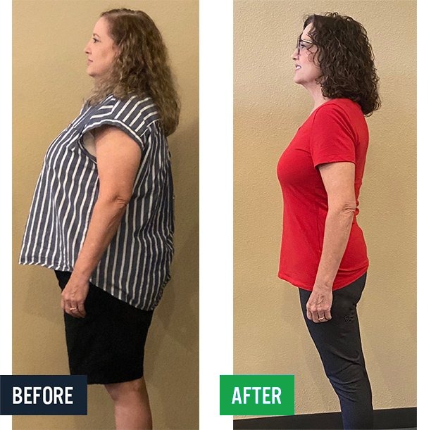 Kerry side before and after