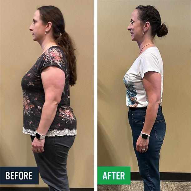 Kristen side before and after