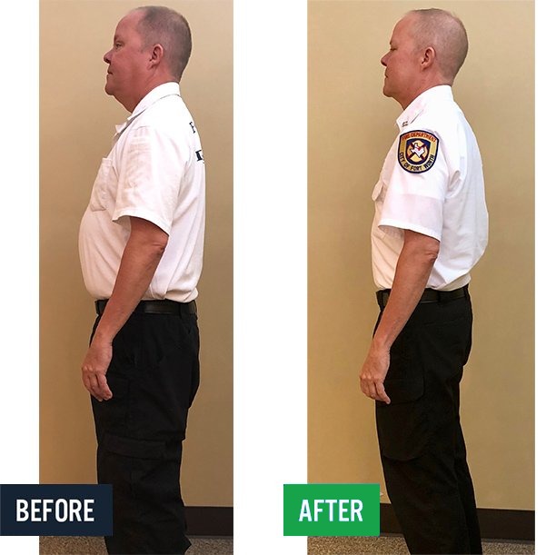 Kyle side before and after