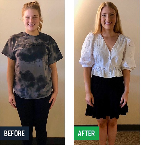 Kylie before and after