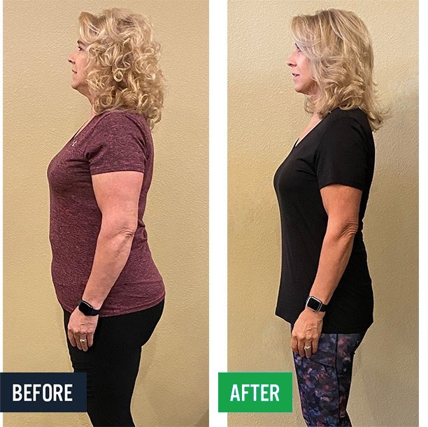 Laura side before and after