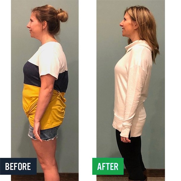 Lauren side before and after