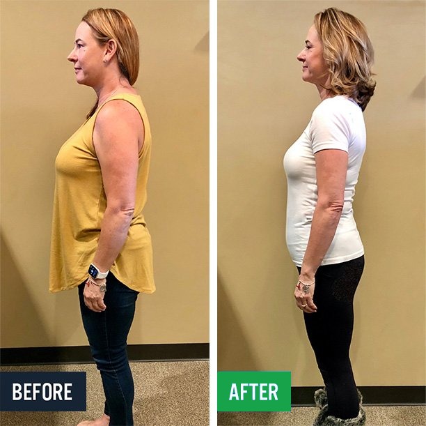 LeeAnna side before and after