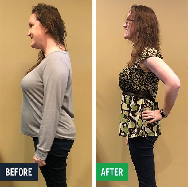 Lilly side before and after