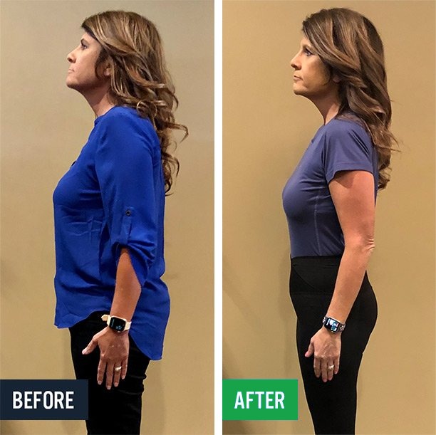 Lisa side before and after