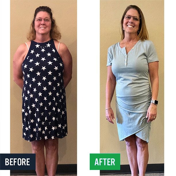 Lisa before and after