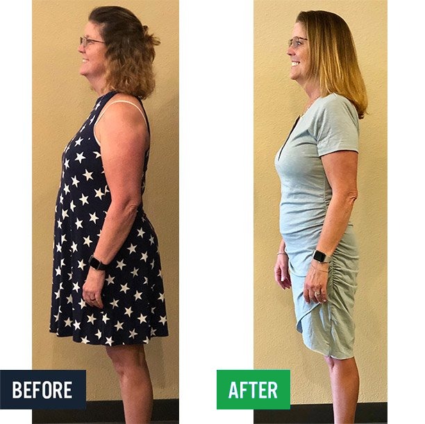 Lisa side before and after