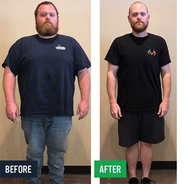 Matt before and after